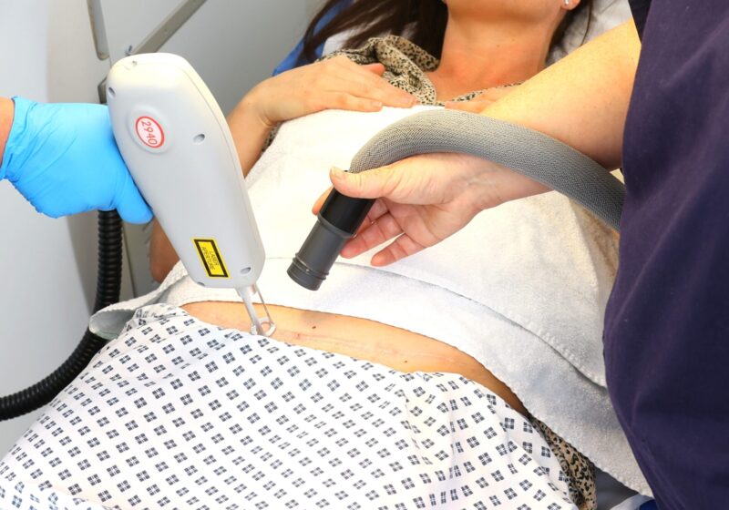 Medical professionals conducting a laser treatment